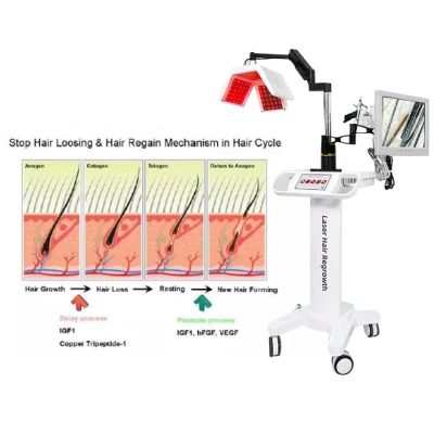 Machine laser de repousse des cheveux 650nm pour le traitement de la perte de cheveux de la croissance des cheveux