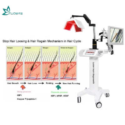 Machine professionnelle de repousse des cheveux au laser à diode de traitement anti-perte de cheveux